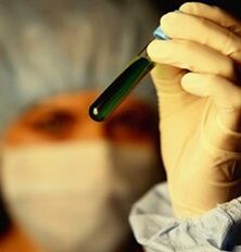 ինչպես անցնել թեստավորում մակաբույծների համար